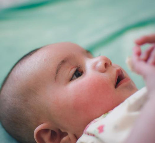 Υᴨερευαίσθητο δέρμα - Mustela Multi-market - 1